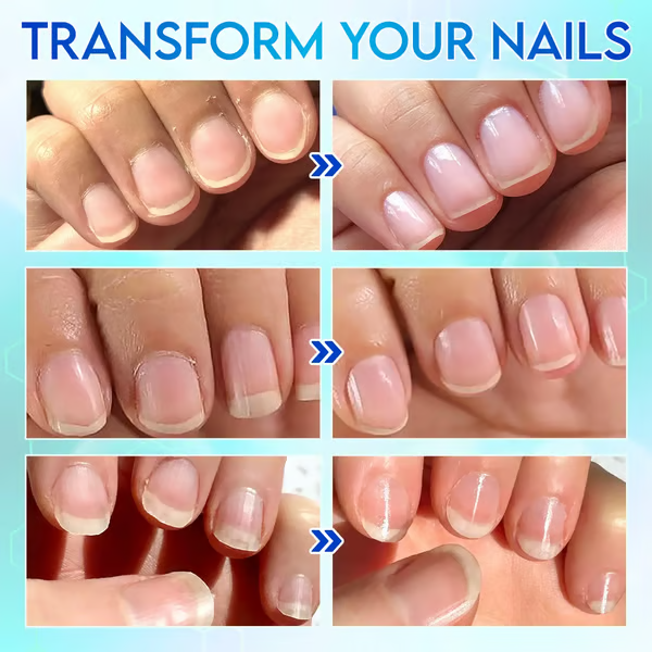 💅✨Universal Automatic Fingernail Grinder for Adults and Children👶